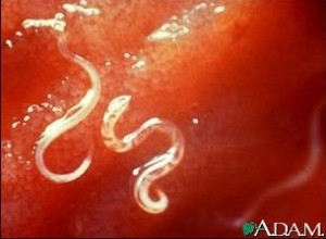 Microscopic Hookworm Courtesy: CDC